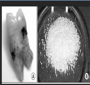 tooth-derived-bone-regeneration