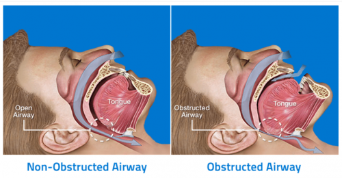 temporomandibular