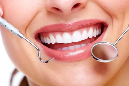 dental-check-up