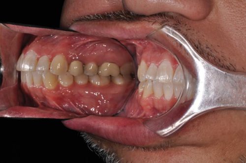 dental-x-rays