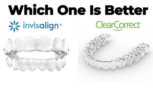 invisalign-vs-clearcorrect