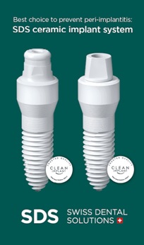 sds-ceramic-implant-system