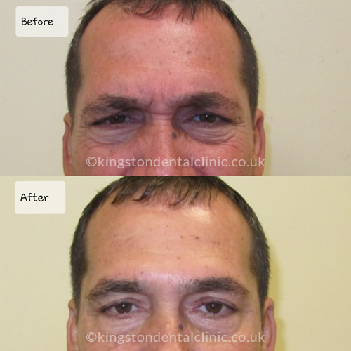 Facial Aesthetics