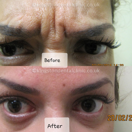 Facial Aesthetics