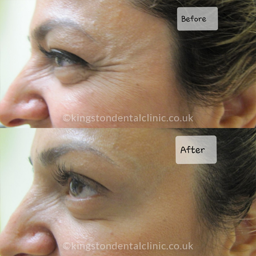 Facial Aesthetics