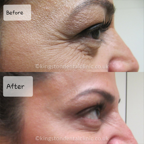 Facial Aesthetics