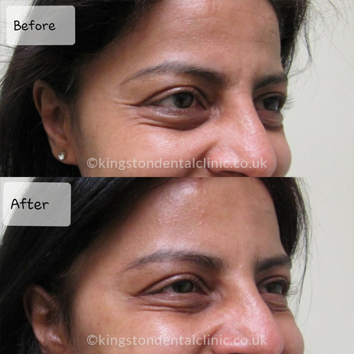 Facial Aesthetics
