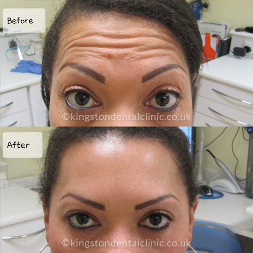 Facial Aesthetics