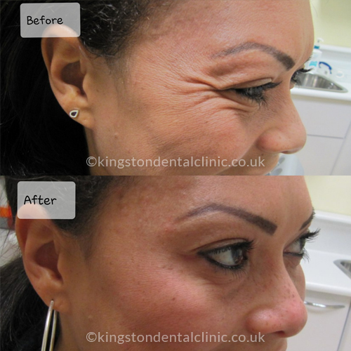 Facial Aesthetics
