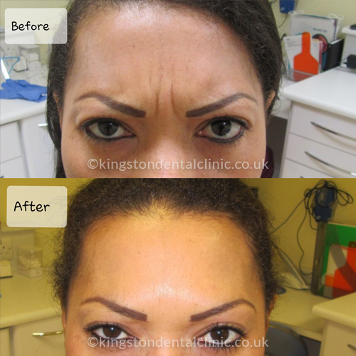 Facial Aesthetics