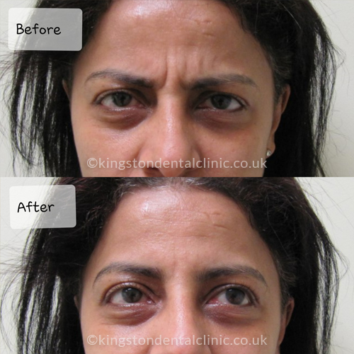 Facial Aesthetics