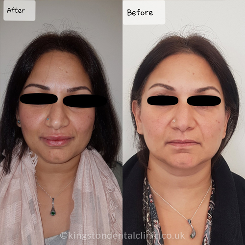 Facial Aesthetics