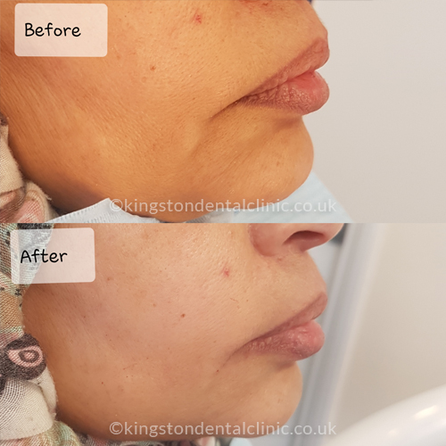 Facial Aesthetics