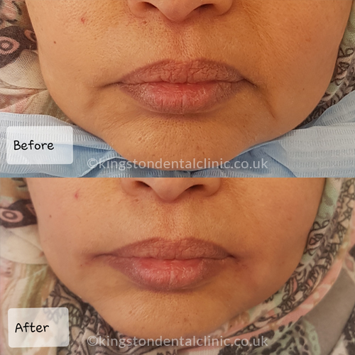 Facial Aesthetics