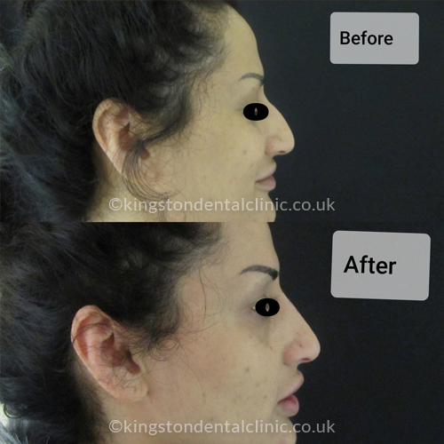 Facial Aesthetics