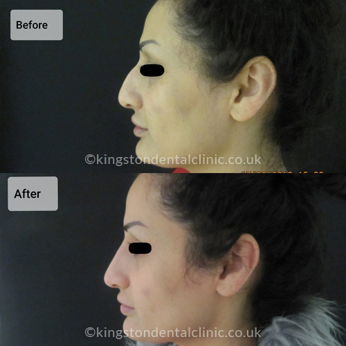 Facial Aesthetics