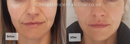 Facial Aesthetics