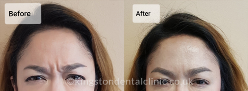 Facial Aesthetics