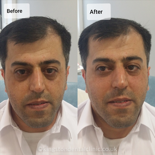 Facial Aesthetics