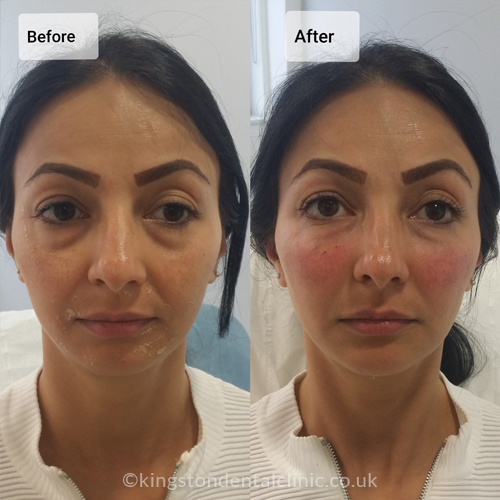 Facial Aesthetics