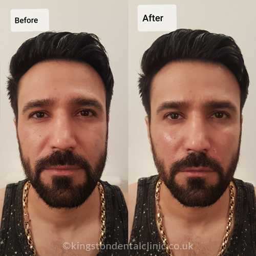 Facial Aesthetics