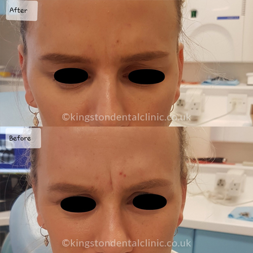 Facial Aesthetics