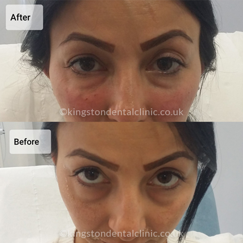 Facial Aesthetics