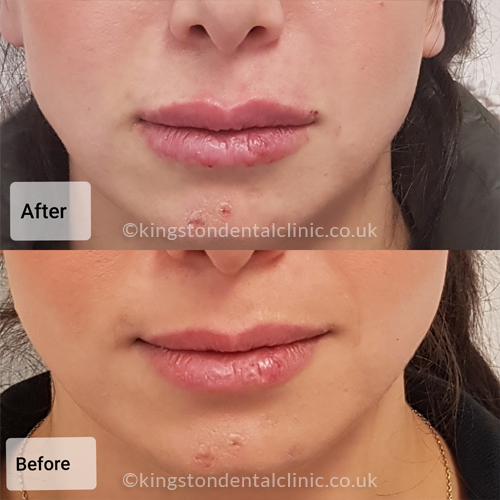 Facial Aesthetics