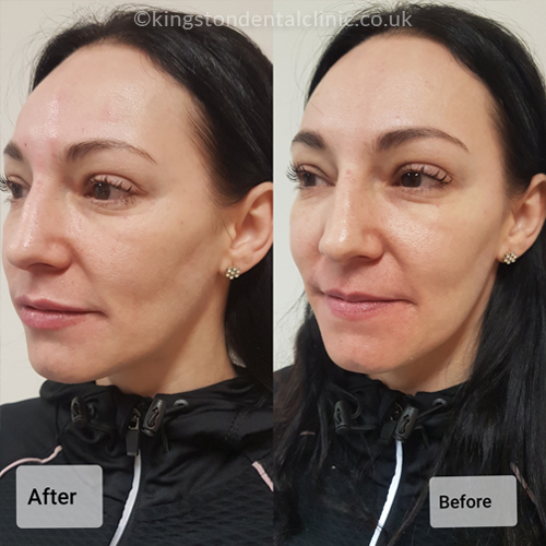 Facial Aesthetics