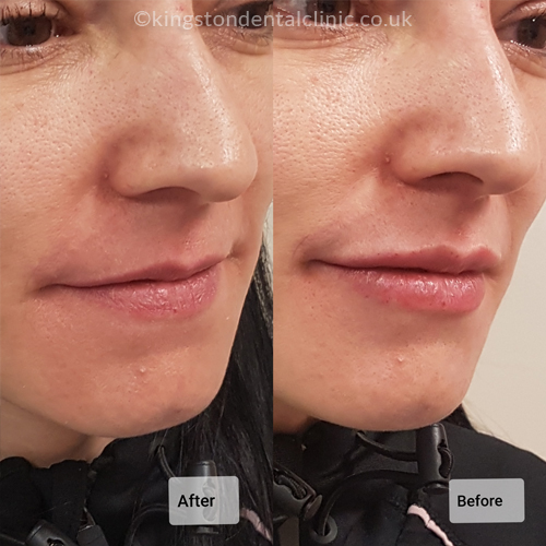 Facial Aesthetics