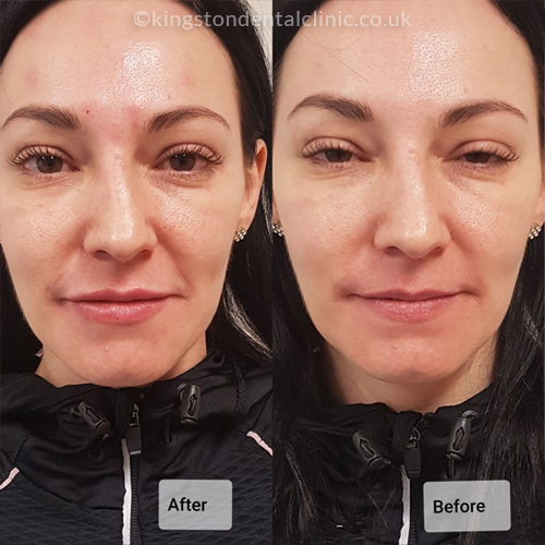 Facial Aesthetics