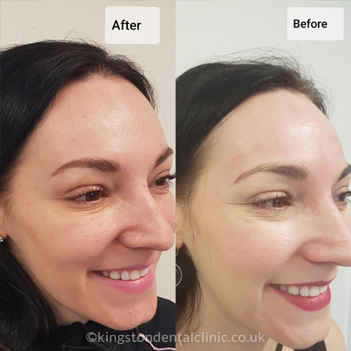 Facial Aesthetics