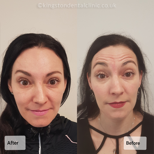 Facial Aesthetics