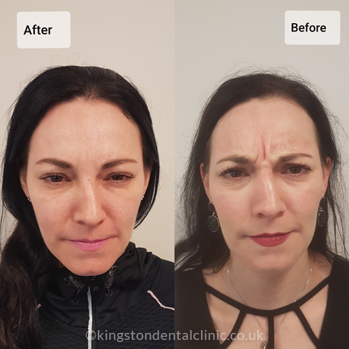 Facial Aesthetics