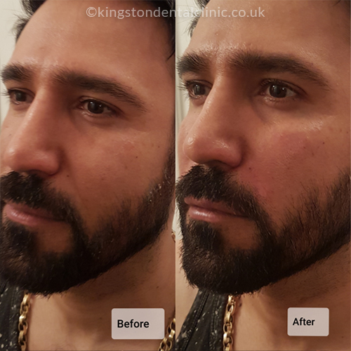 Facial Aesthetics