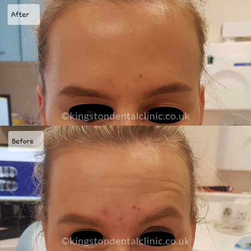 Facial Aesthetics