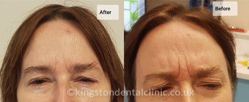 Facial Aesthetics