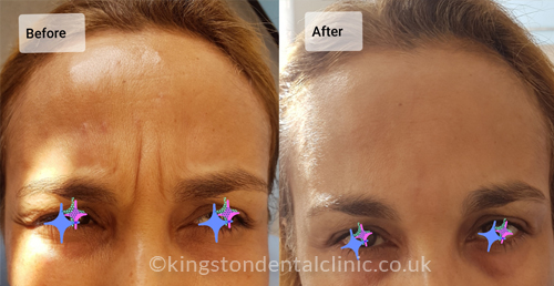 Facial Aesthetics