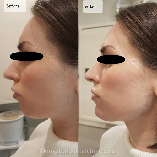 Facial Aesthetics
