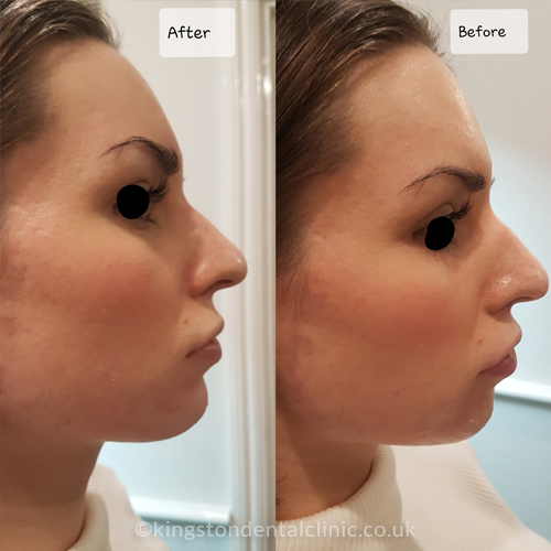 Facial Aesthetics