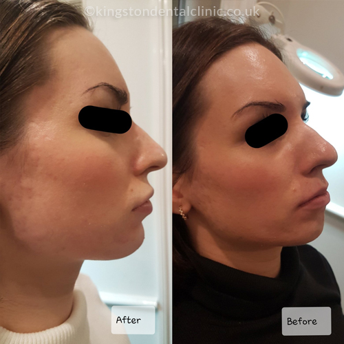 Facial Aesthetics