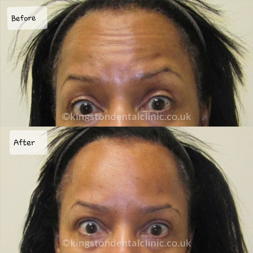 Facial Aesthetics