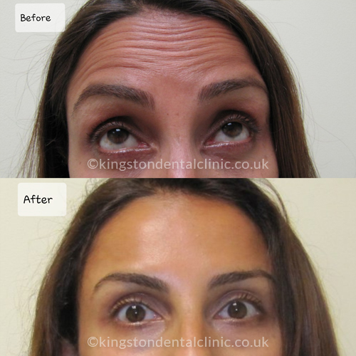 Facial Aesthetics